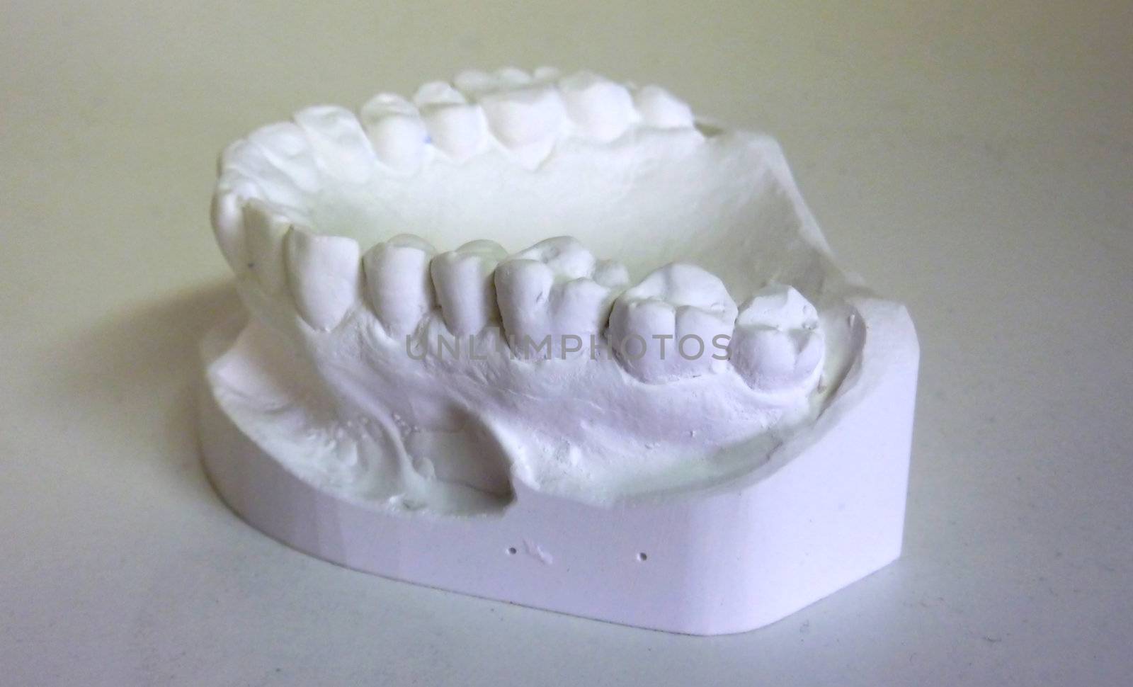 Plaster teeth by Elenaphotos21