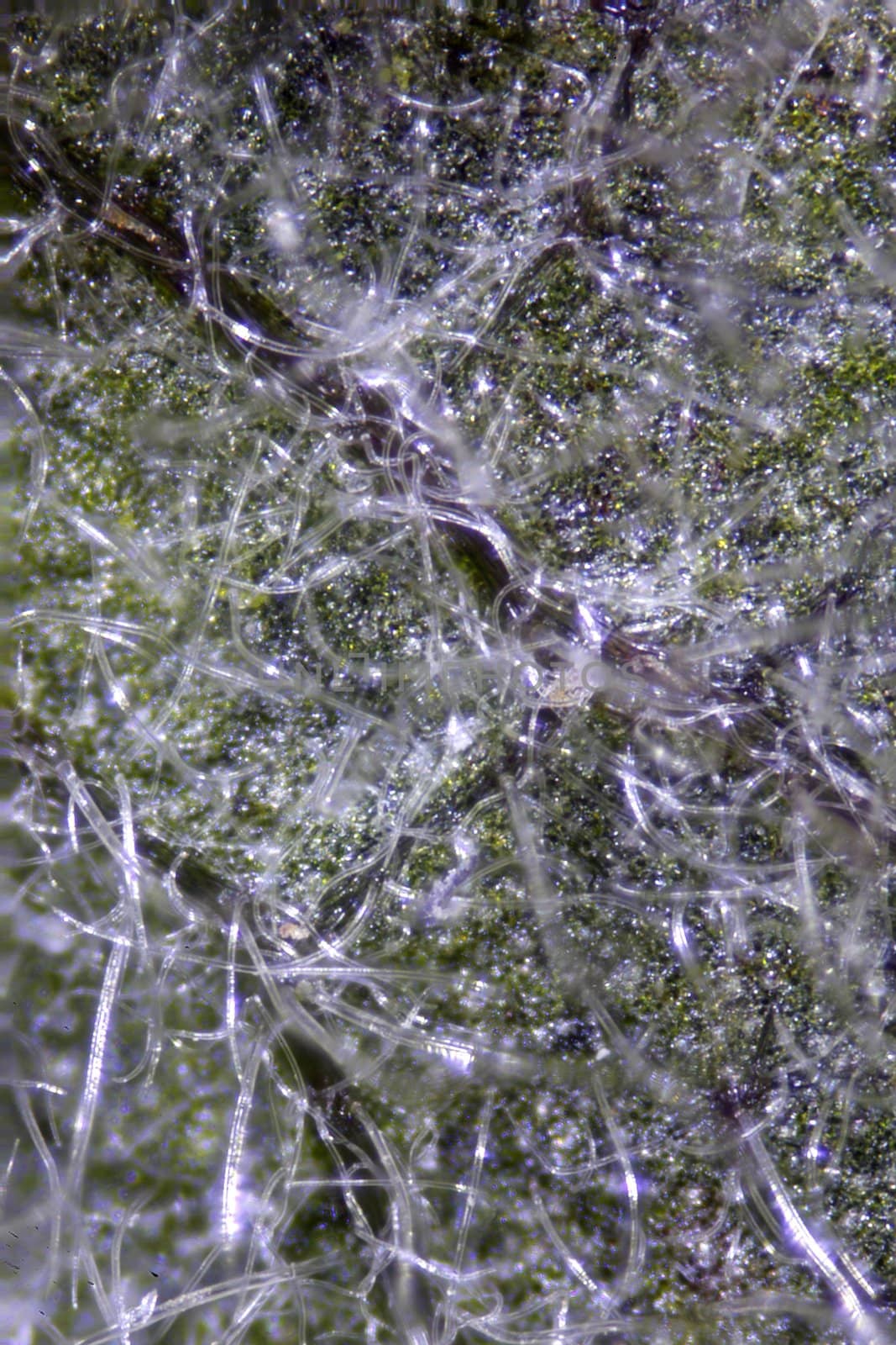 Back of diseased leaf and msome pest tracks causing disease. Micrograph of leaf at 100X. Microscopic vegetation taken during the month of April 2010