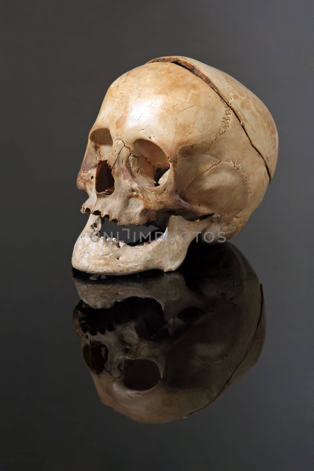 real skull by rorem