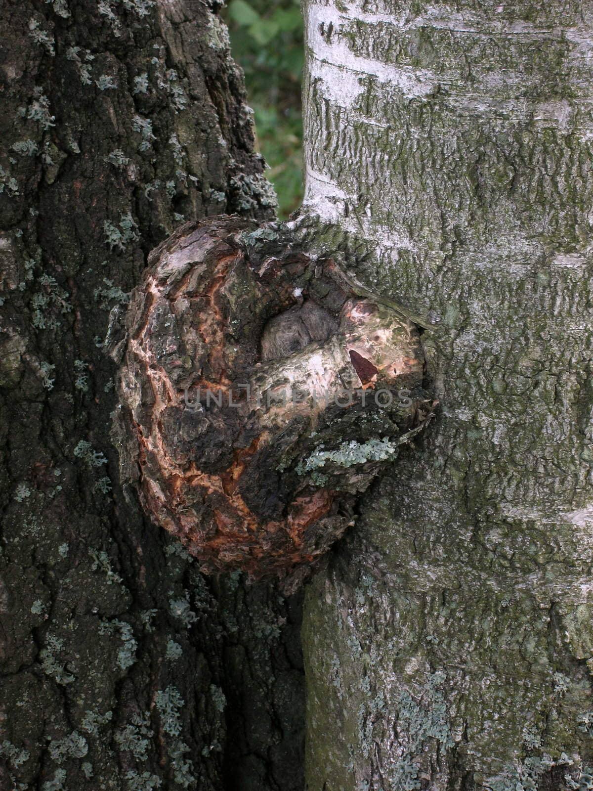 Excrescence on the birch tree trunk