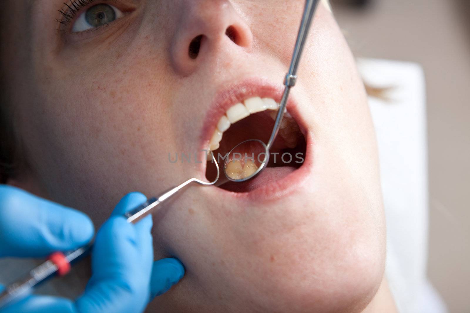 Female patient in the dentist chair for checkup