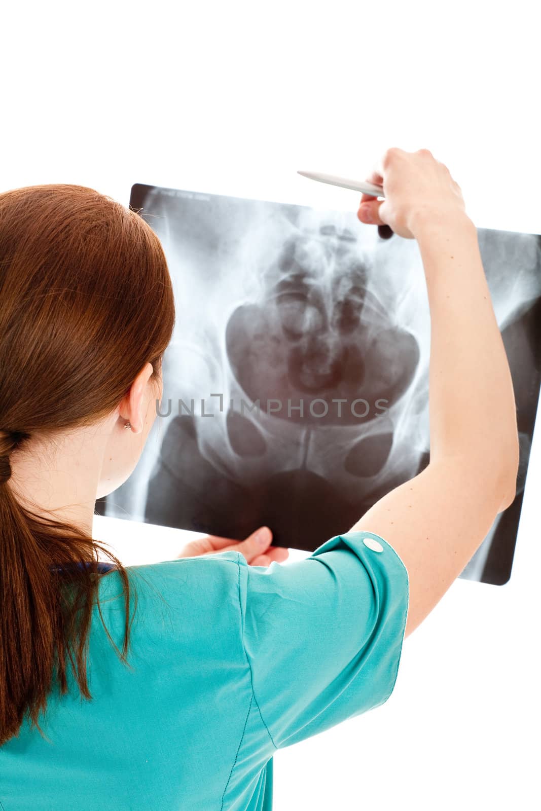 Rear view of young female doctor examining a xray by Nobilior