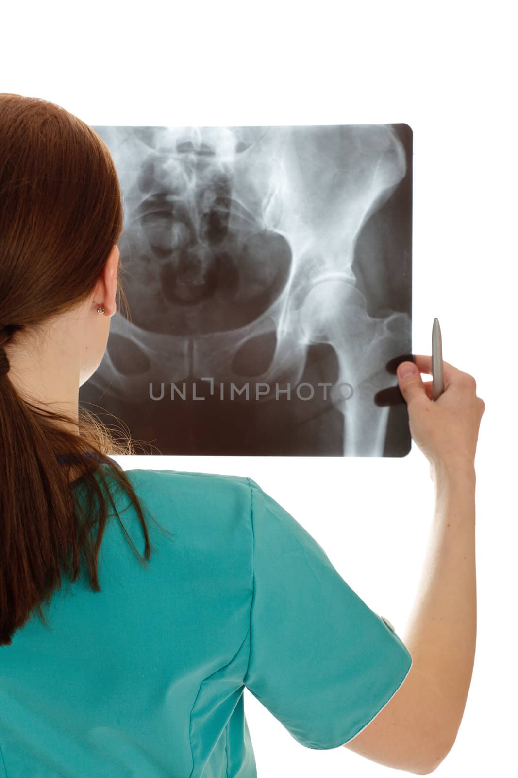 Rear view of young female doctor examining the xray by Nobilior