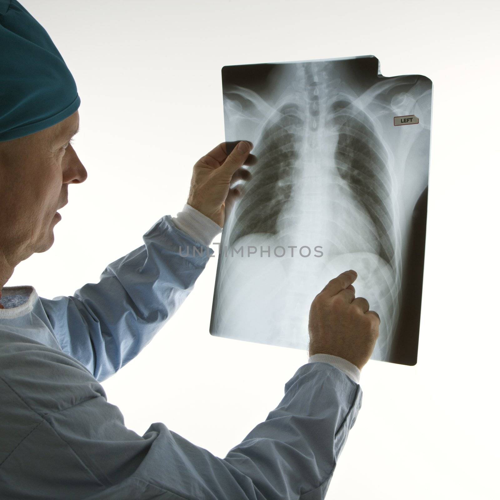 Mid-adult Caucasian male doctor pointing at an x-ray.