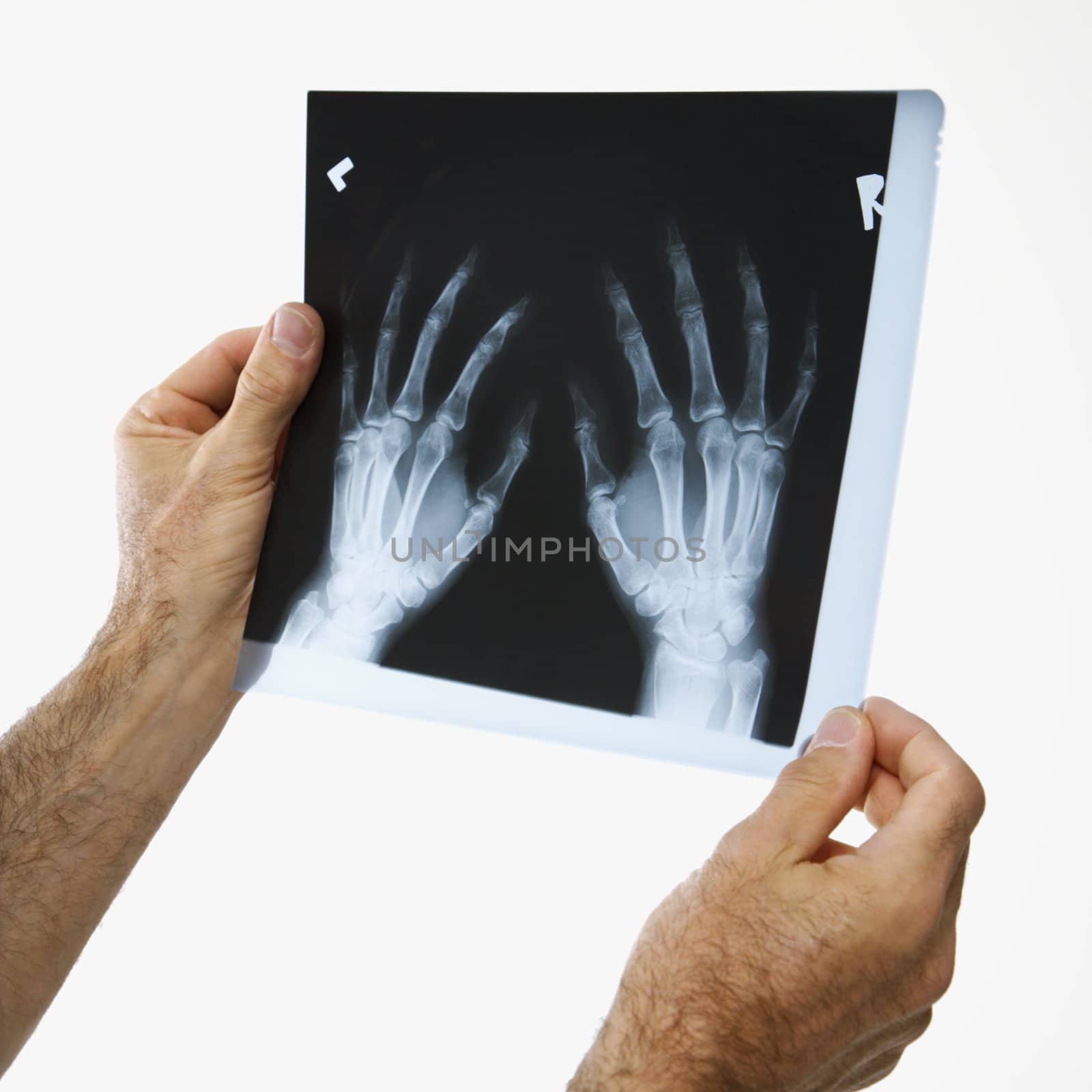 Man holding a x-ray. by iofoto