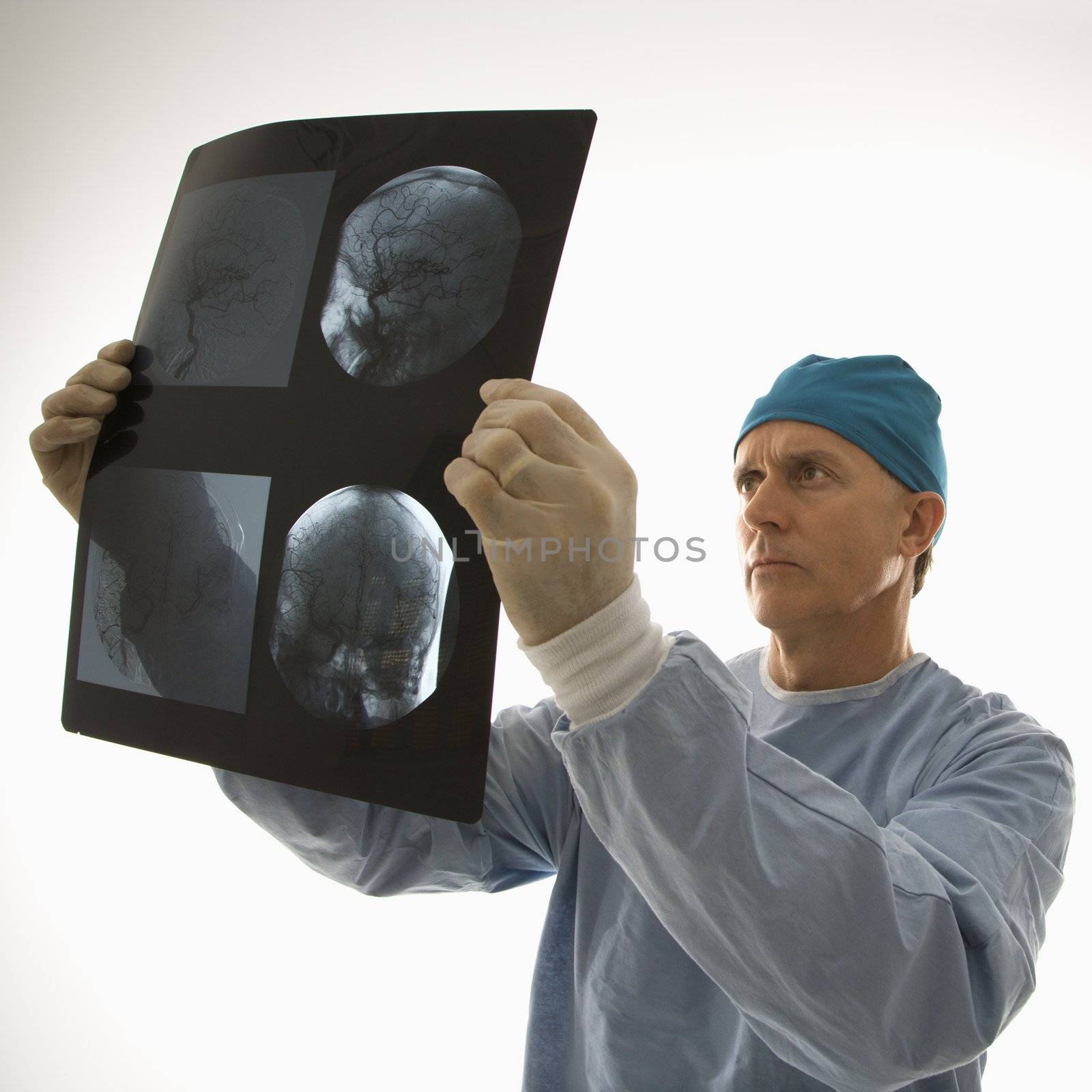 Mid-adult Caucasian male doctor looking at an x-ray.