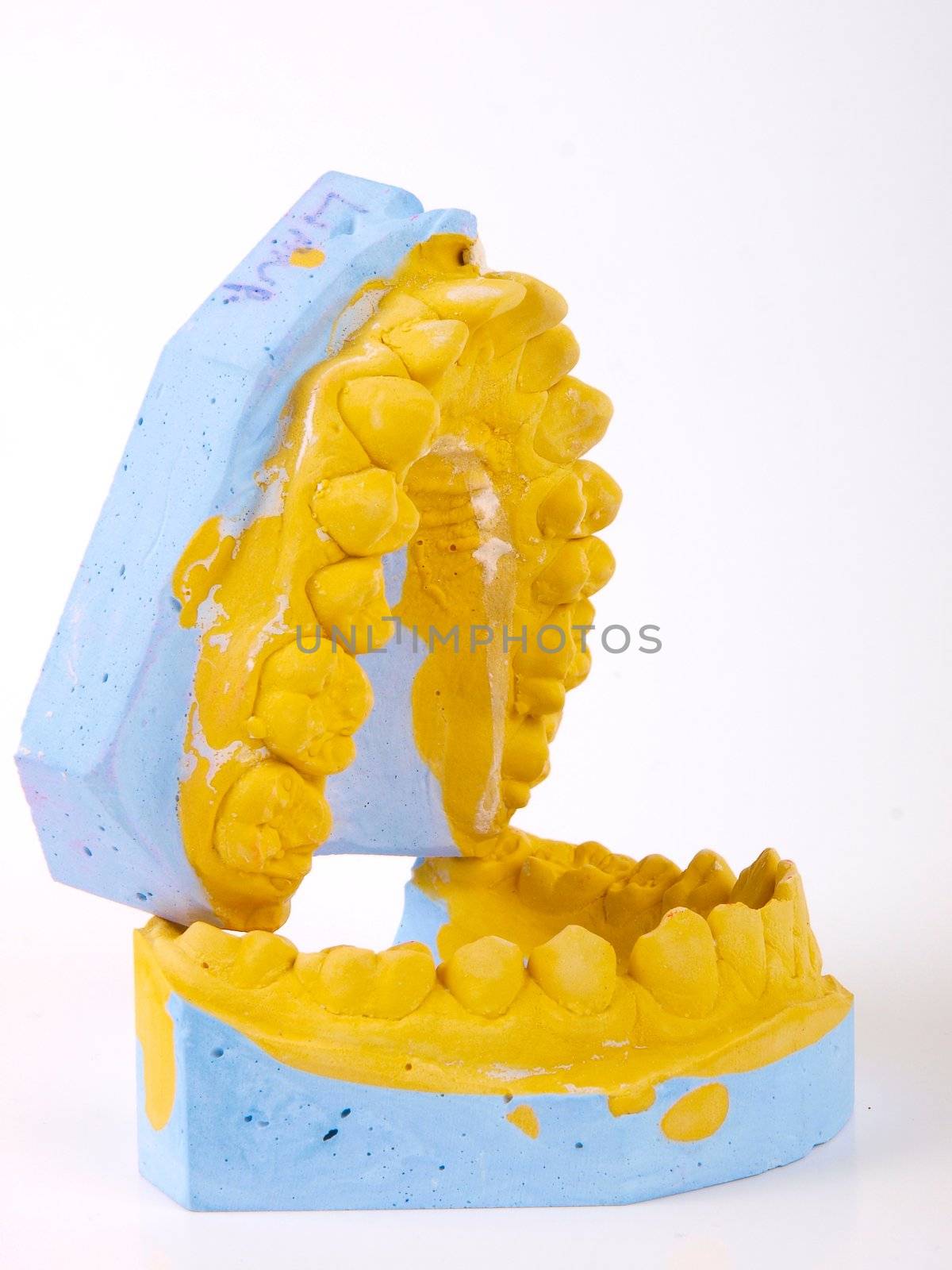 teeth plaster cast by dotweb