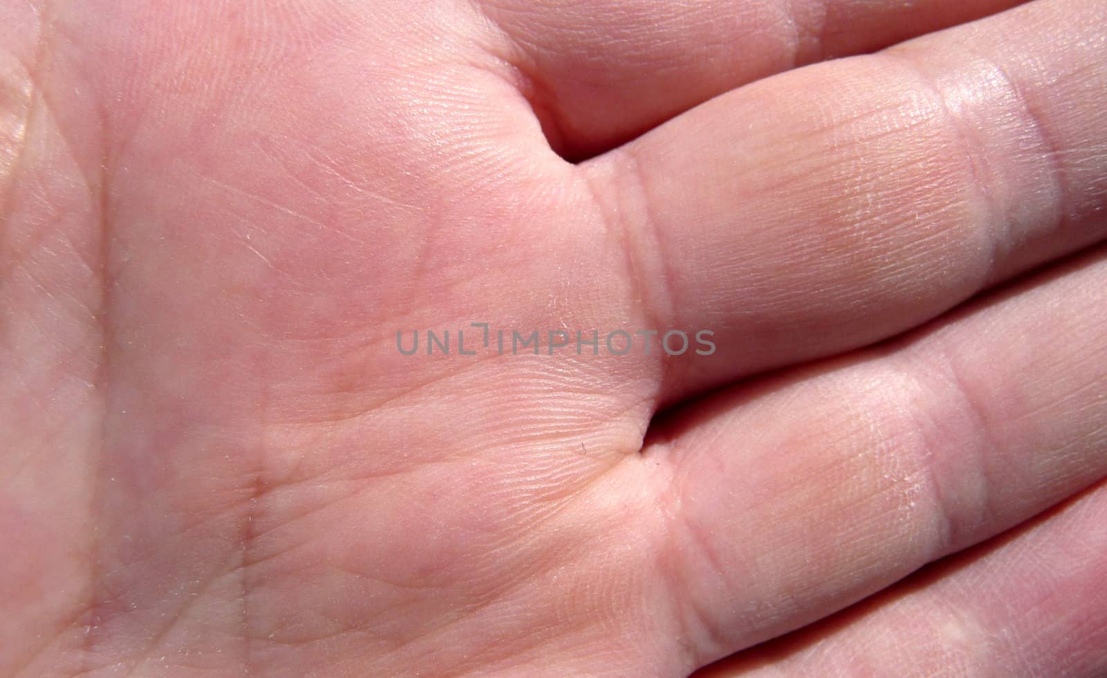 A close up of the skin of a human hand.