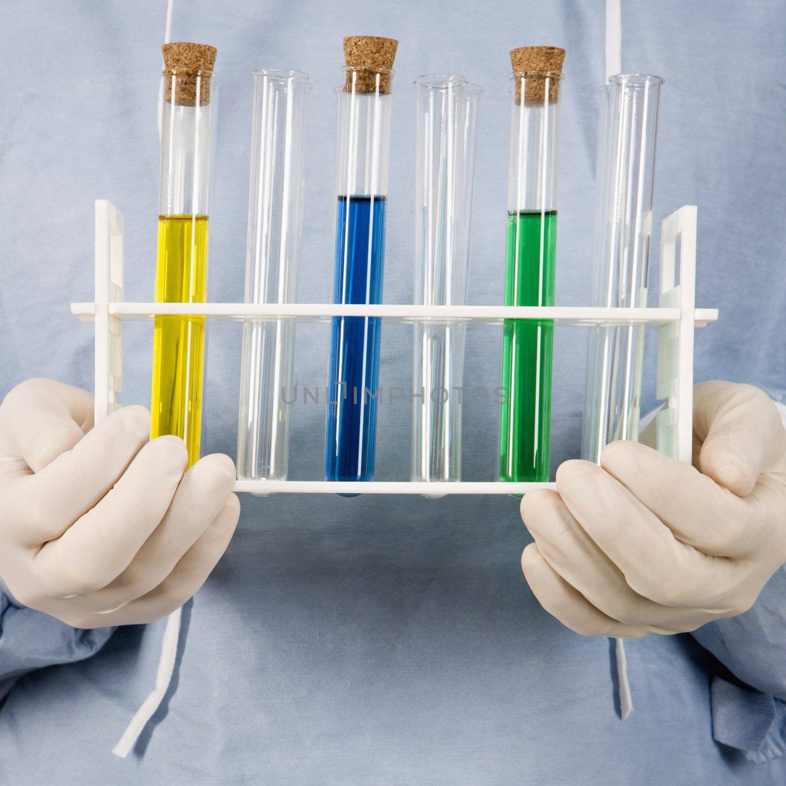 Close-up of male surgeon's hands holding test tube tray.