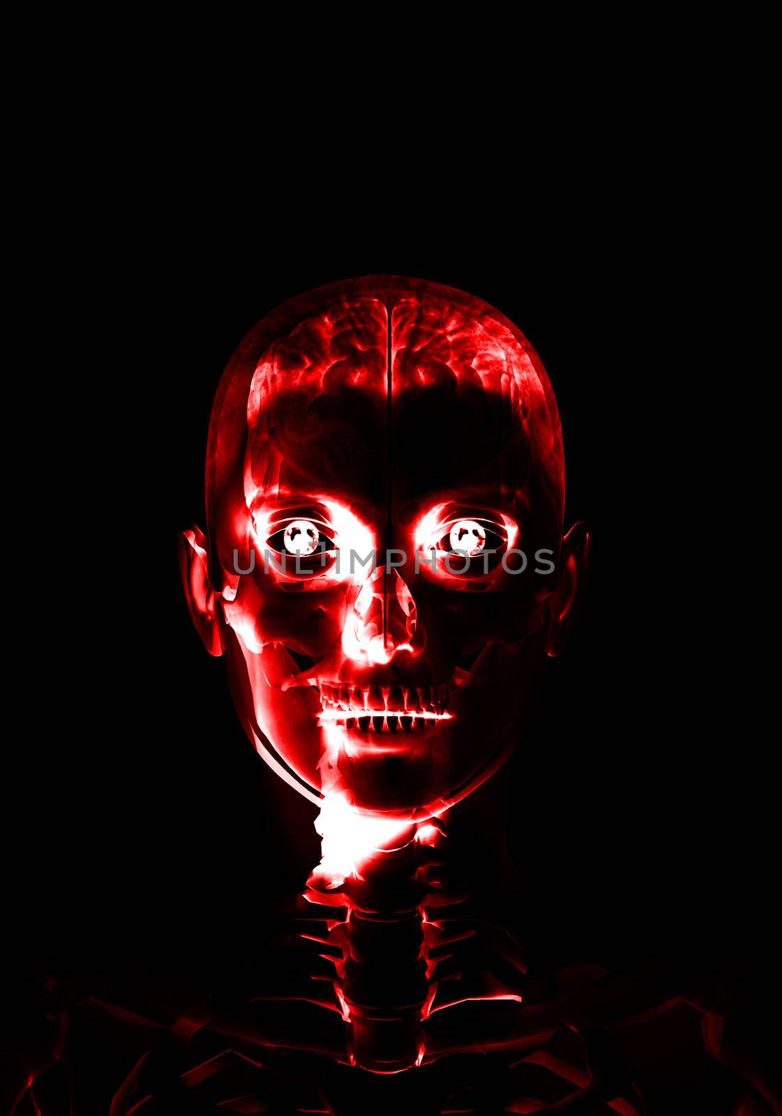 Anatomical X Ray image of a the brain within the head.
