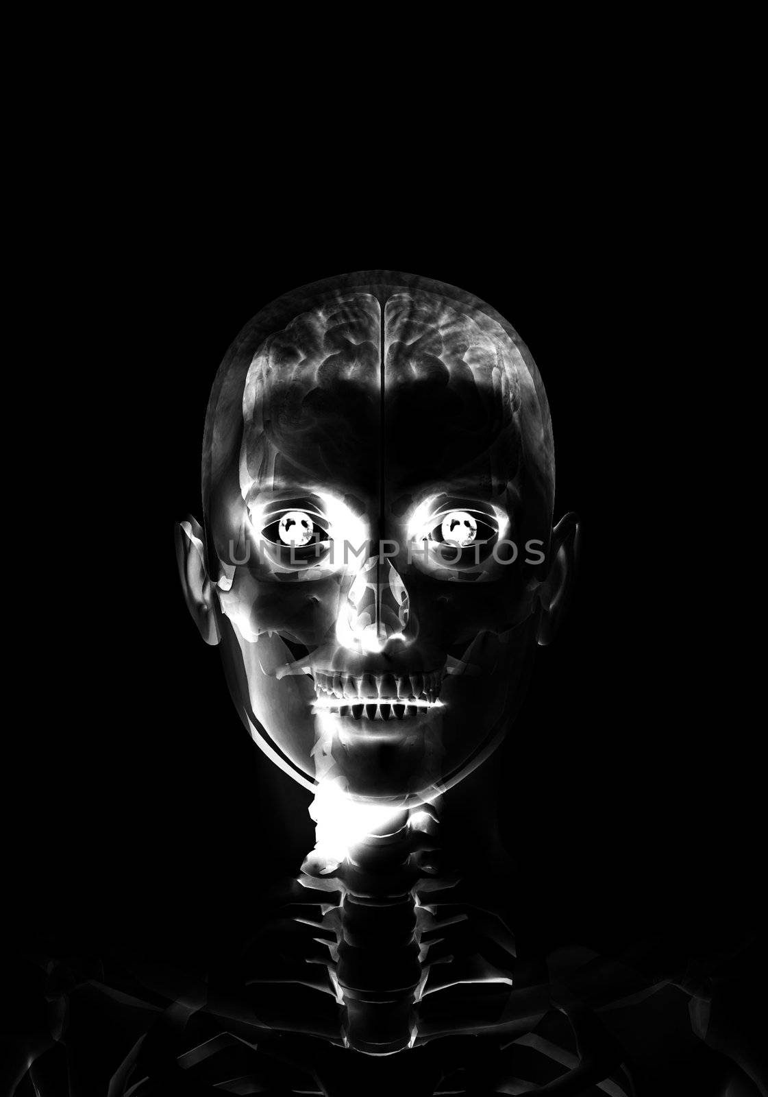 Anatomical X Ray image of a the brain within the head.