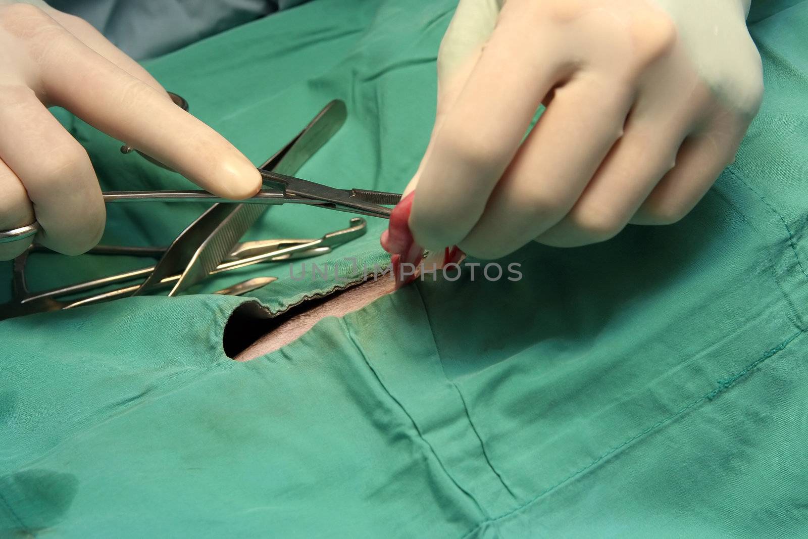 Durgeon doing a procedure on the intestine
