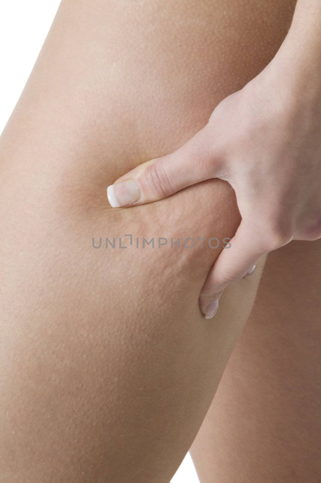 close up on the leg of a girl showing her cellulite