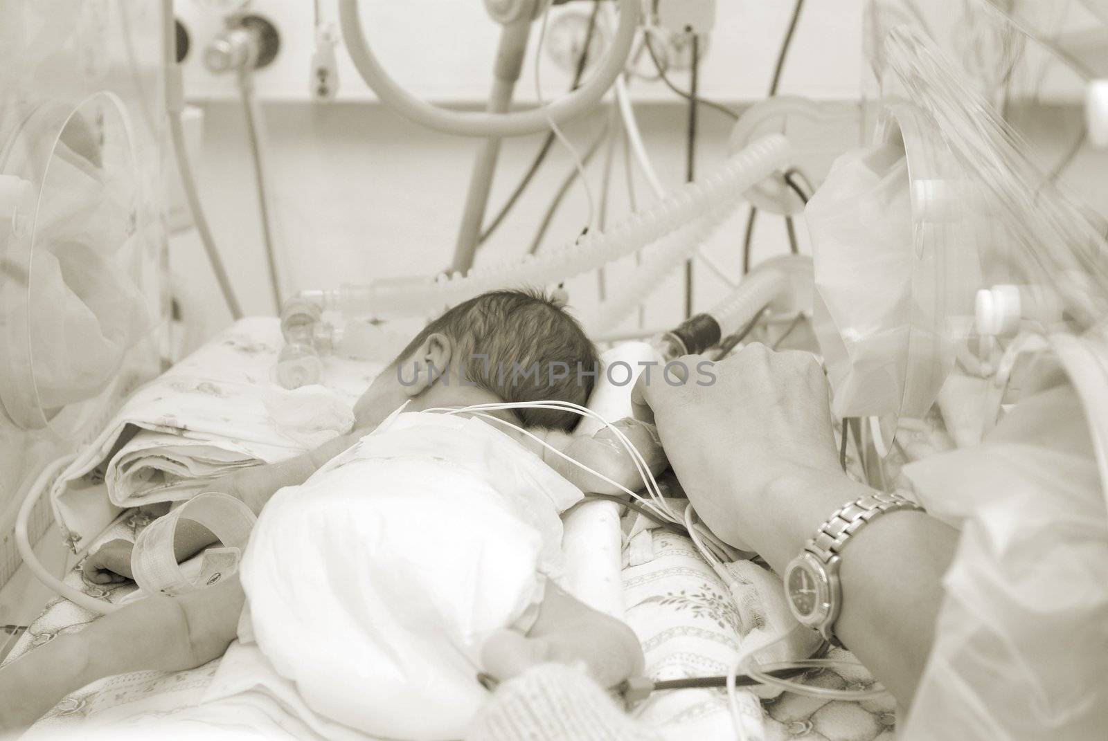 Hand of the physician and newborn in incubator  in hospital