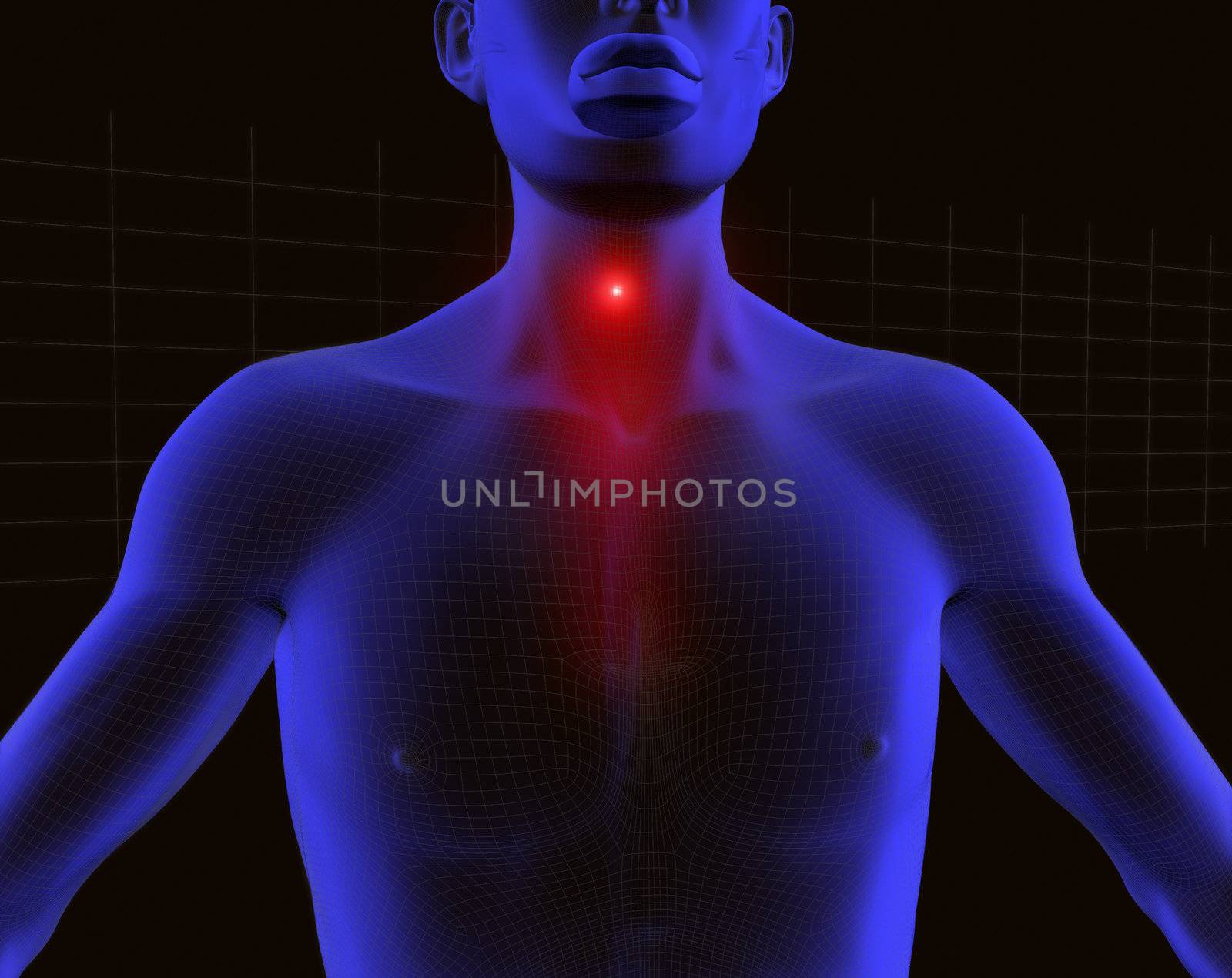 3d image of 3d human with pain in his throat