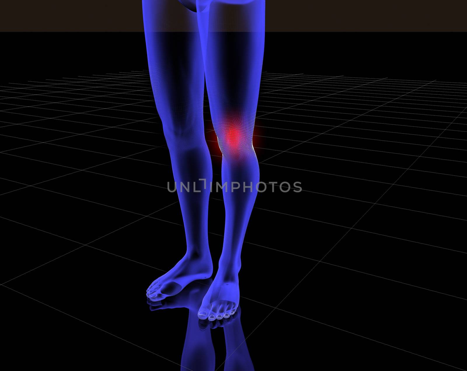 3d image of x-ray of legs  with red pain in the knee