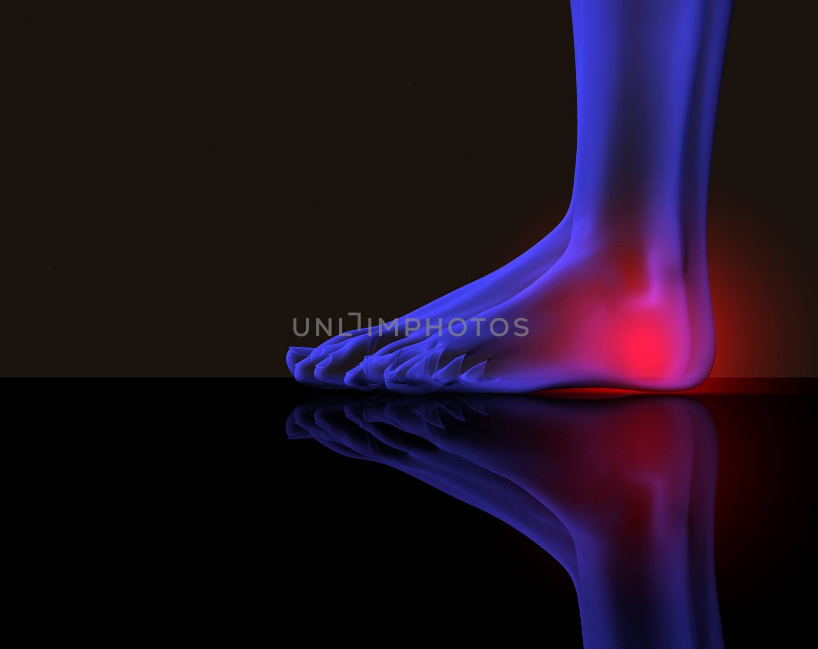 x-ray of a foot with red pain