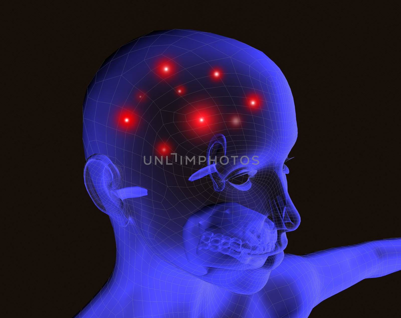 3d image of a head with headache