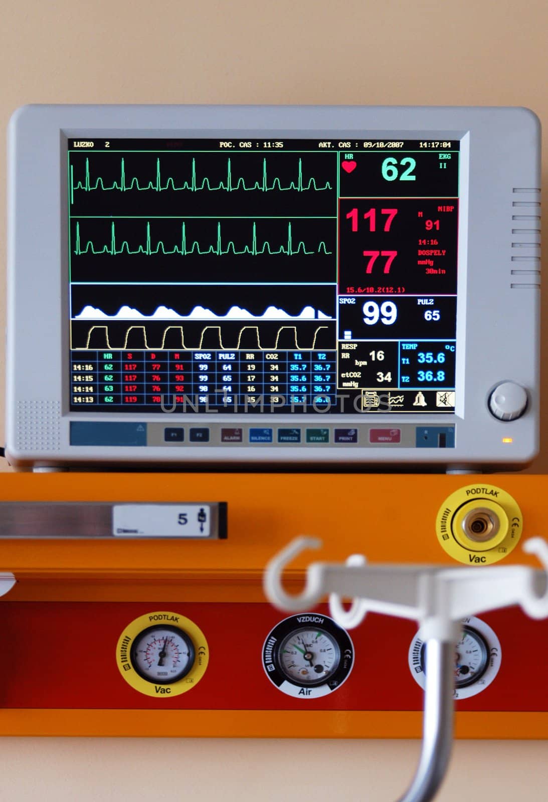 Diagnostic instrument displaying pulse, blood-pressure and other informations by haak78