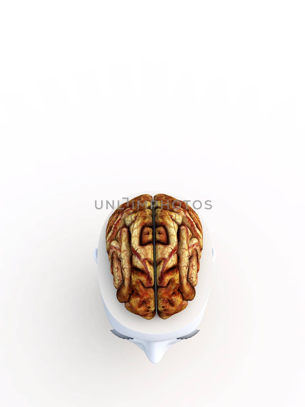 An anatomical open top head revealing a human brain inside.