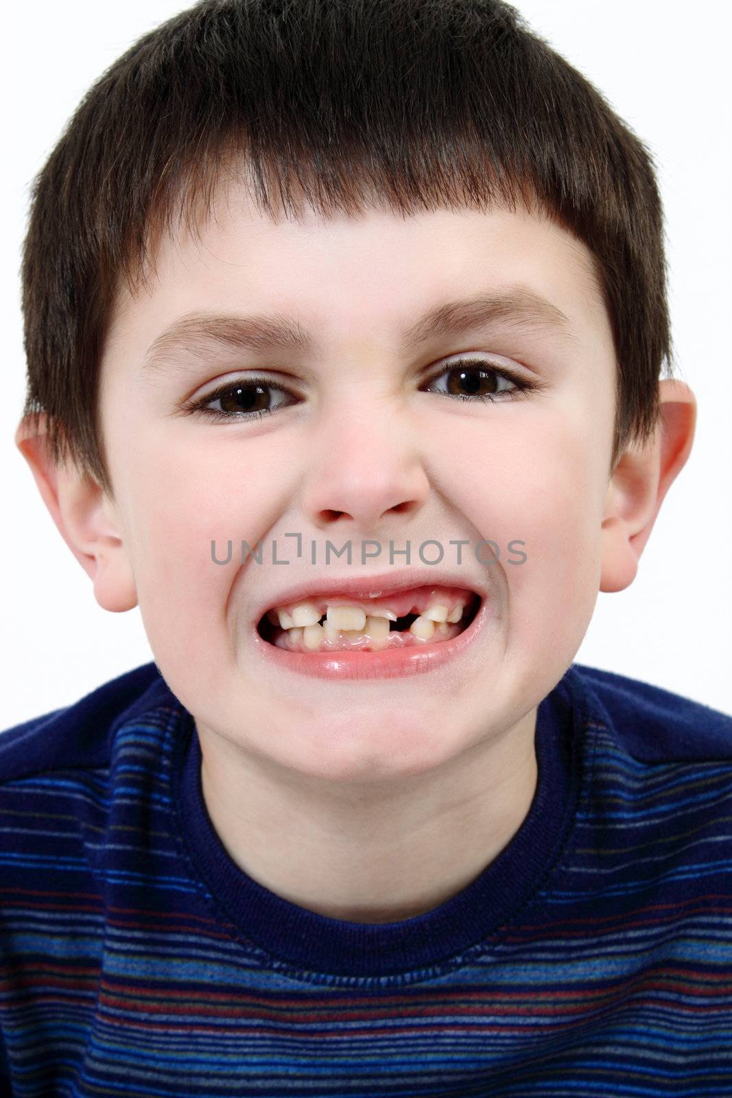 Young boy grimacing by artush