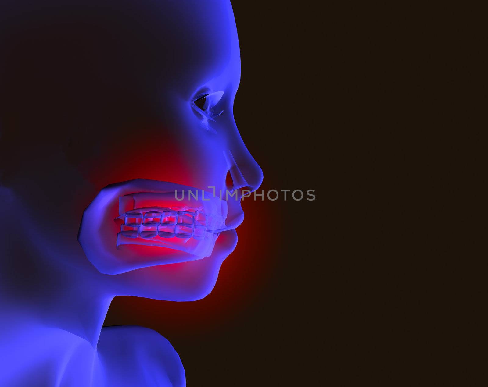 X-ray image of head with mouth pain
