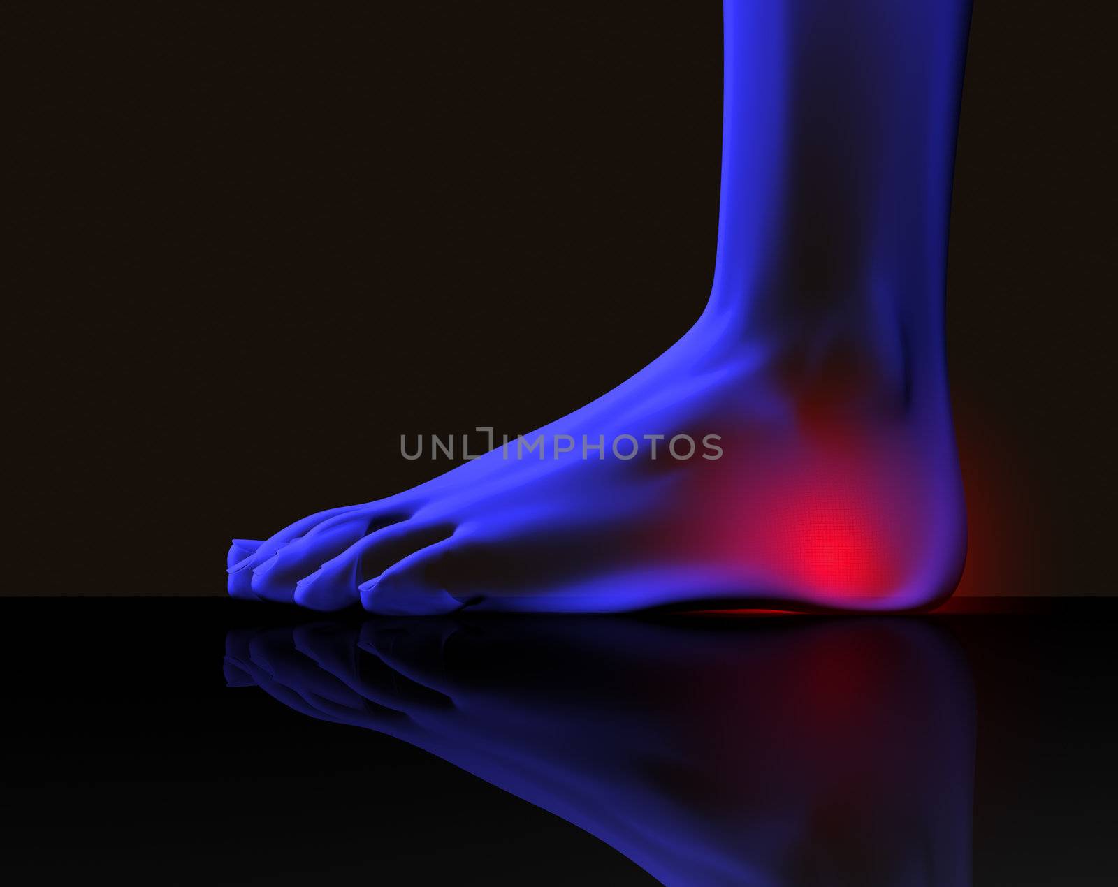 X ray image of foot with pain