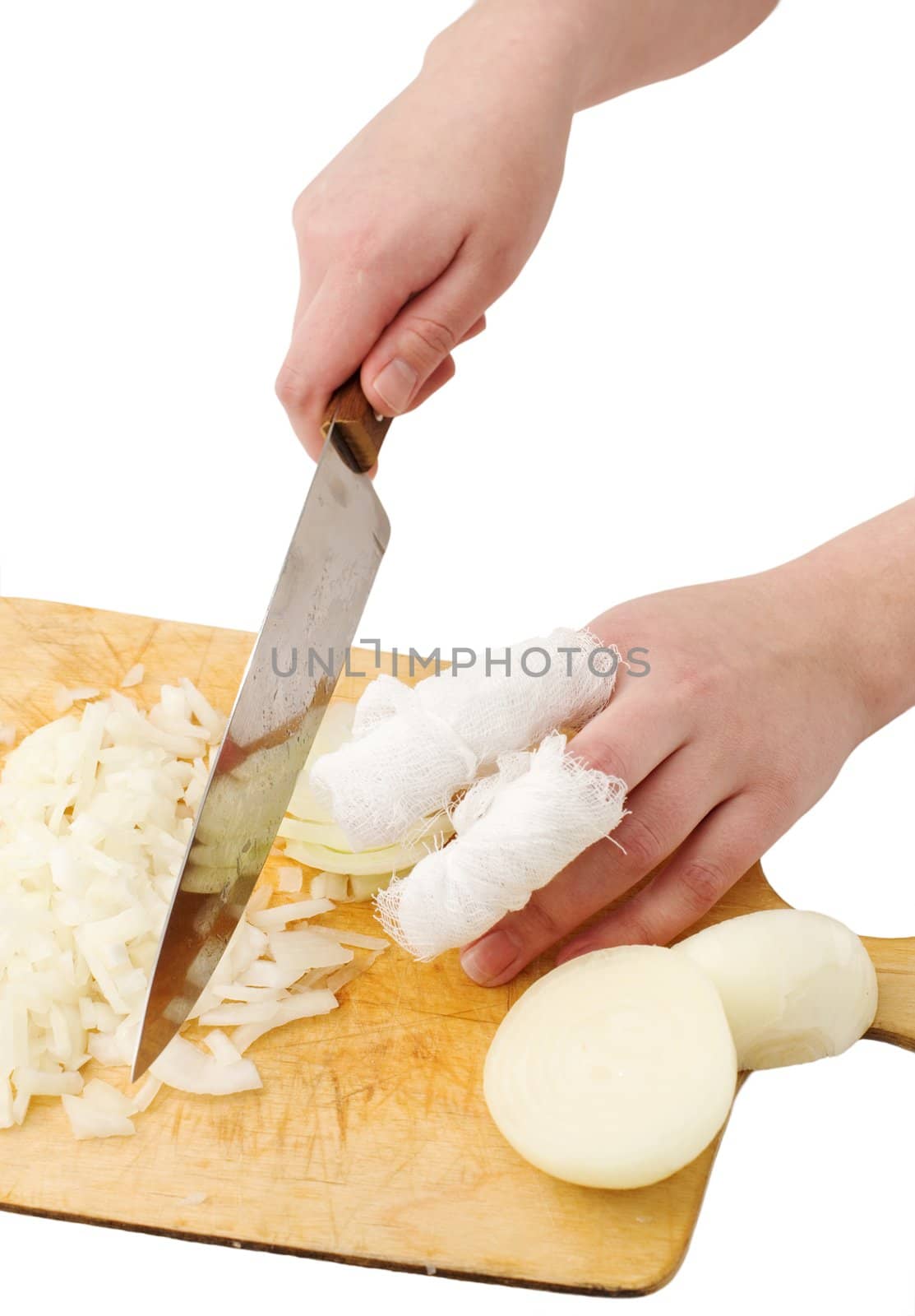 The hands, cutting onions on a chopping board