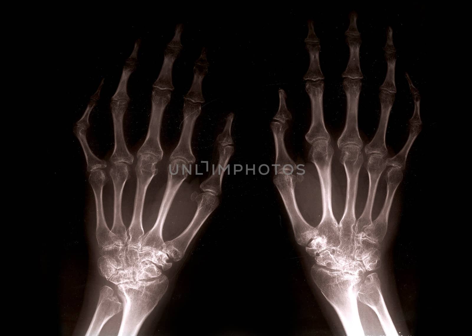 Xray hands by nicemonkey