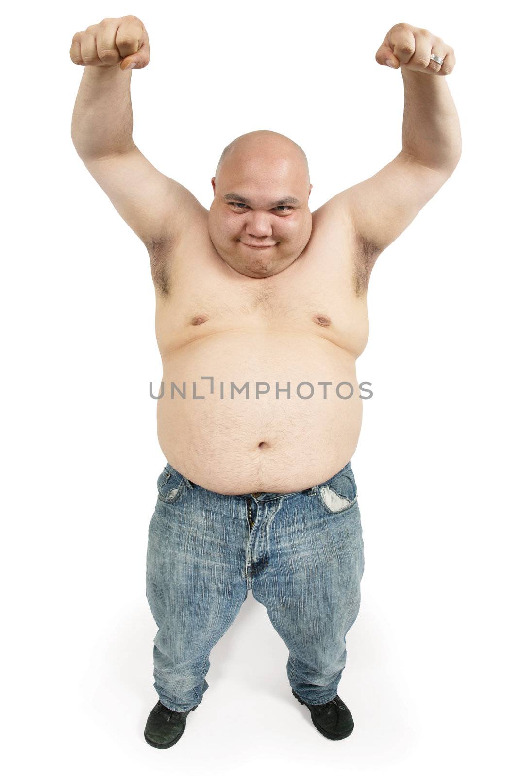 A large bald man with his hands up in the air making an odd face.
