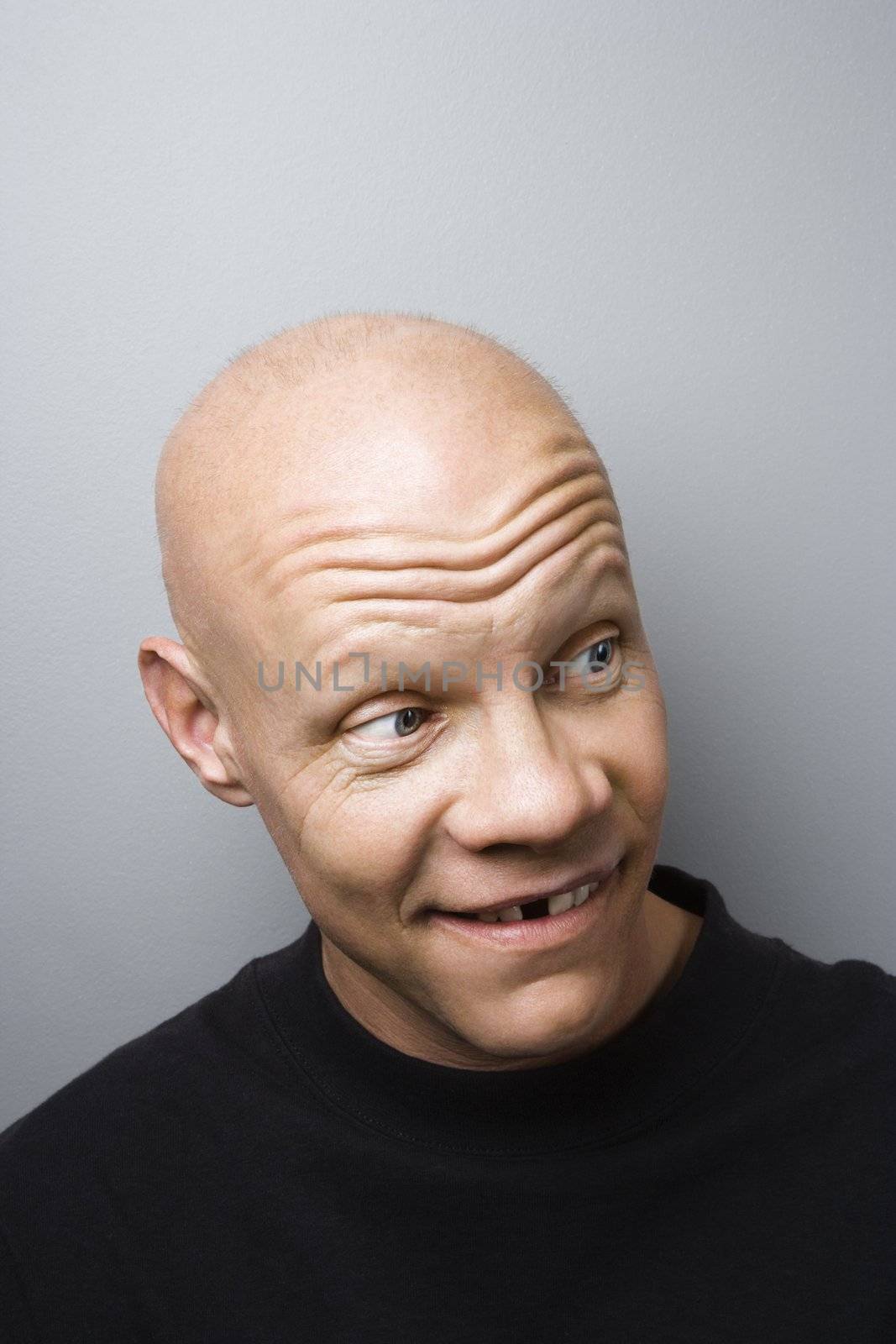 Portrait of mid-adult Caucasian male with missing tooth.