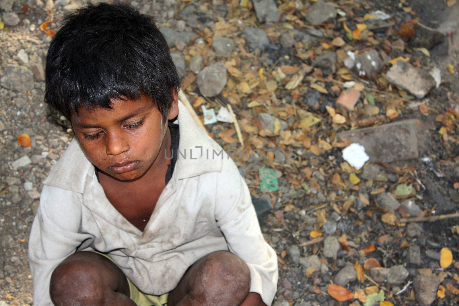 A sick beggar boy sitting hopelessly in his poverty conditions in India.