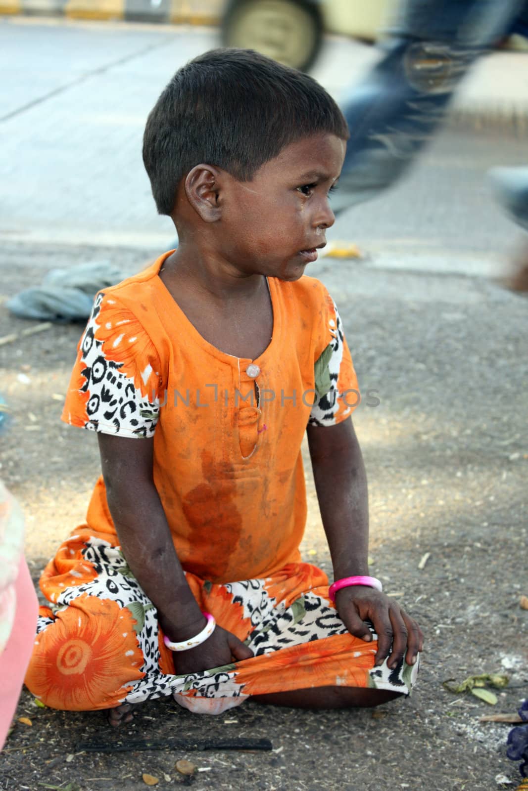 A sick girl from India begging on the streets.