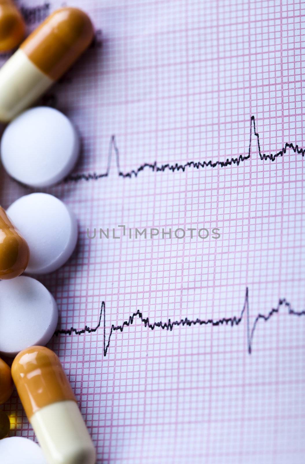 Ekg and  Tablets by JanPietruszka