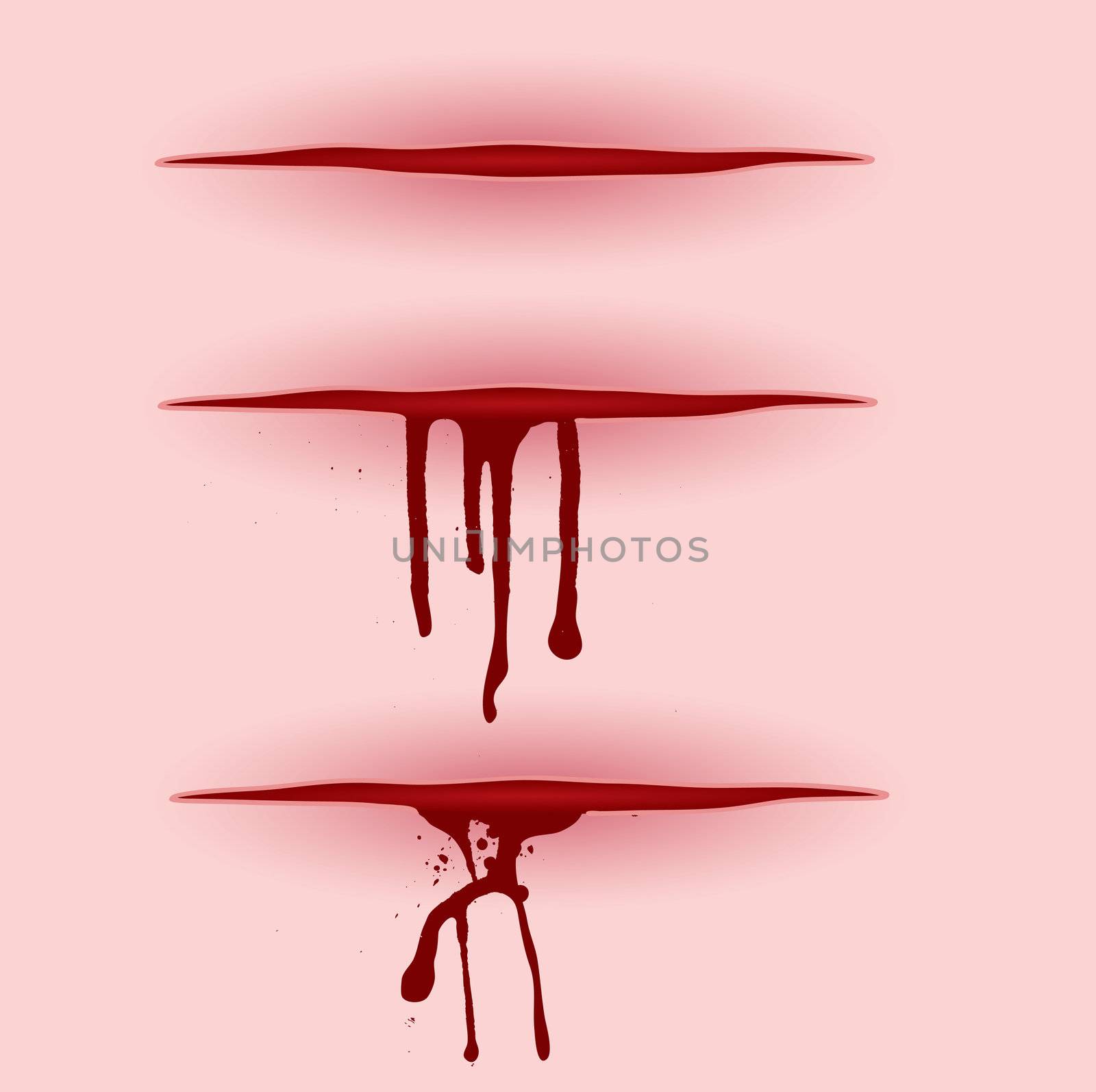 Three illustrated open wounds with blood pooring from them