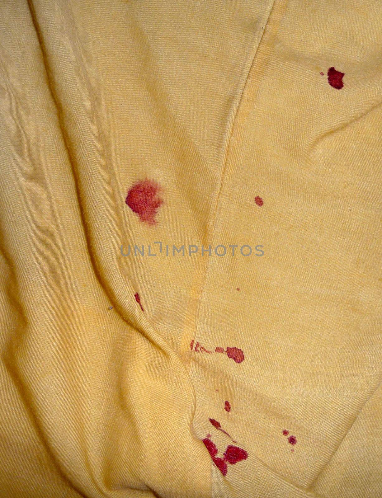 Blood on bedsheets caused by a nosebleed.