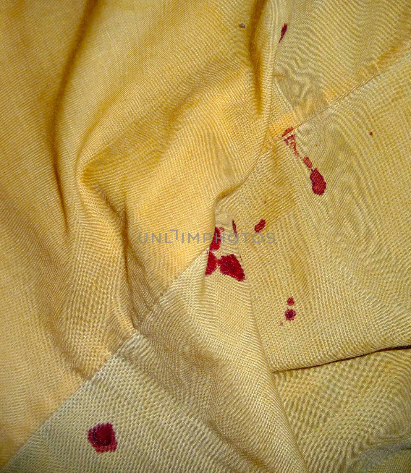 Blood on bedsheets caused by a nosebleed.