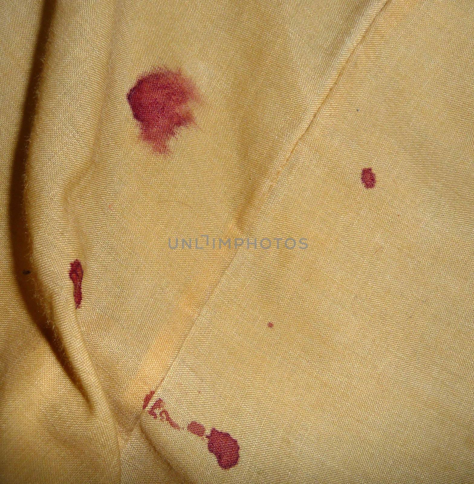 Blood on bedsheets caused by a nosebleed.