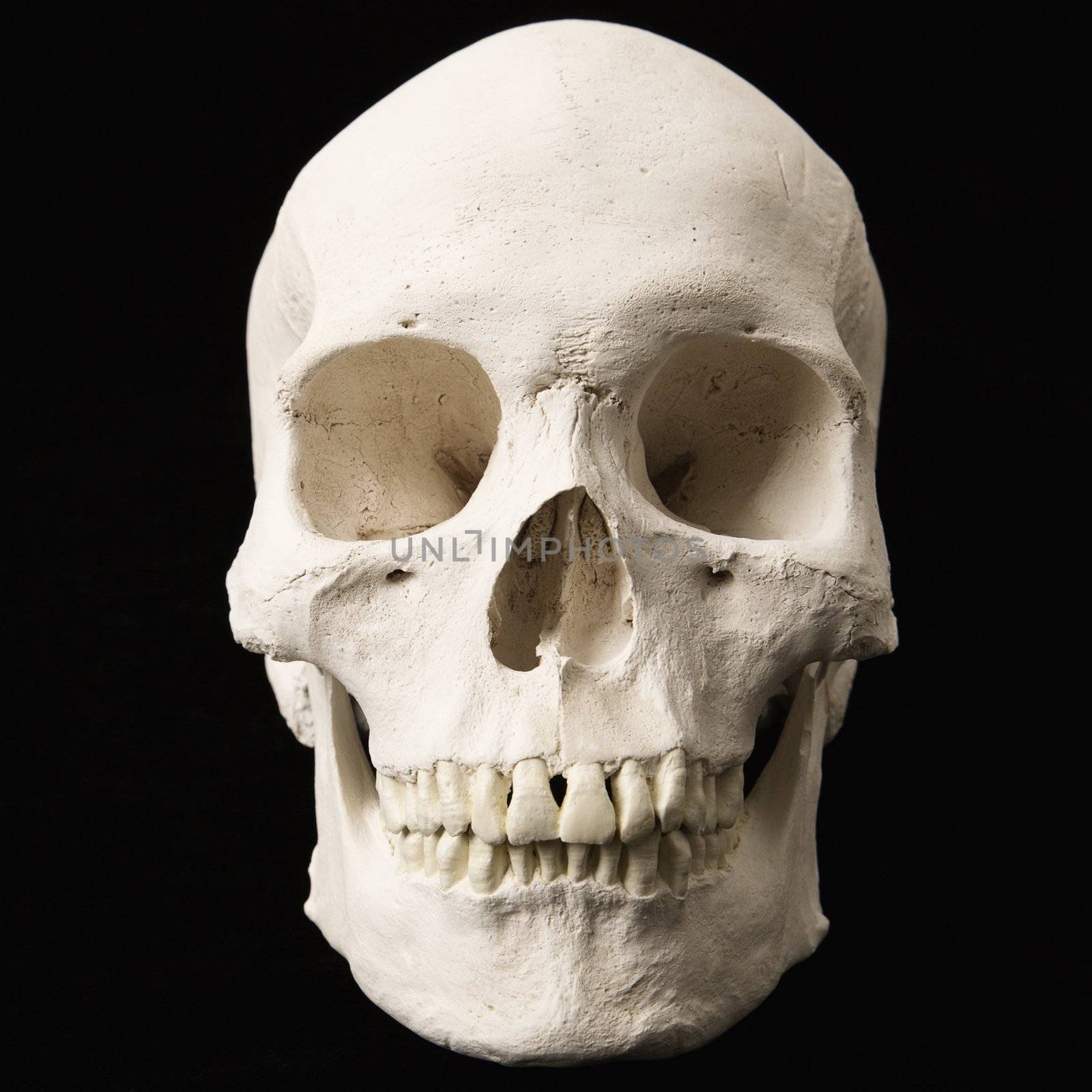 Human skull with teeth on black.