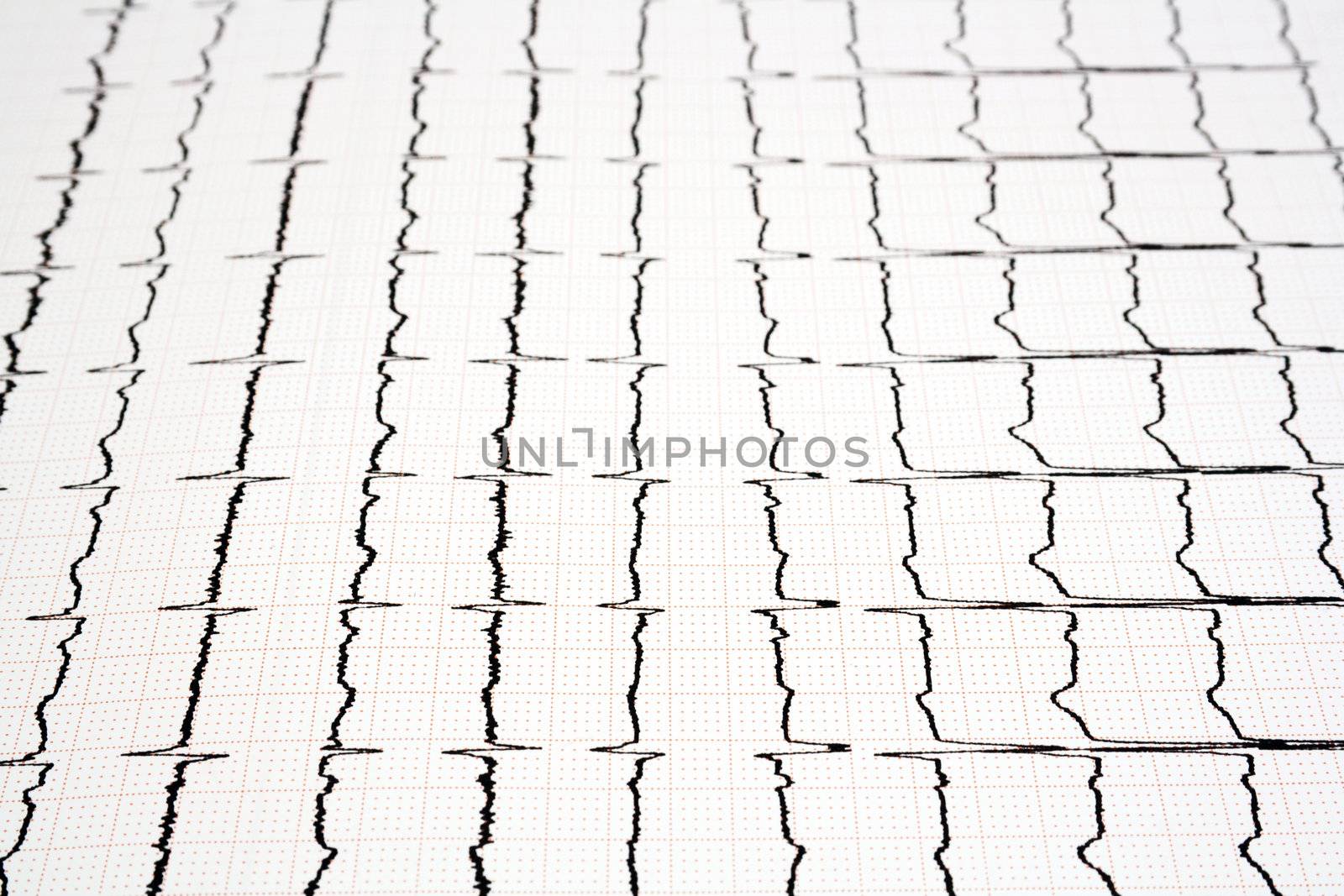 ECG print by magraphics