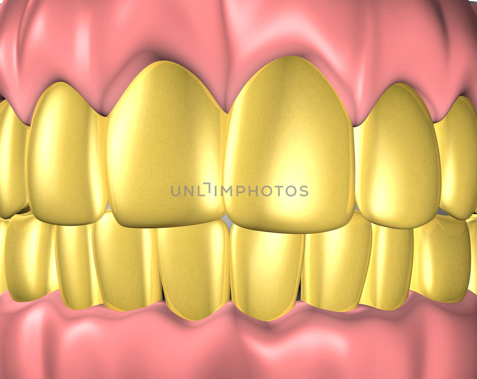 3d image of teeth with gold teeth