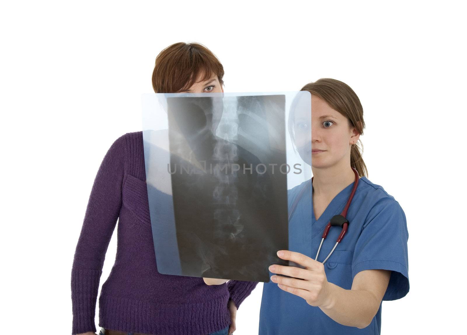 Nurse and patient looking at x-ray with worried expression, on white background.
