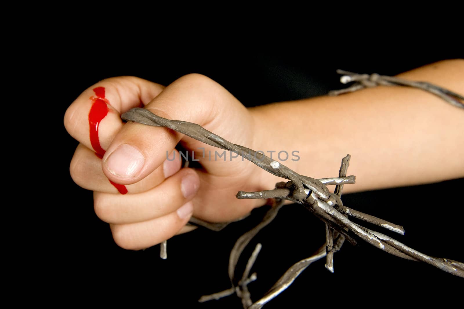 somebody hurts his hand with barbed wire