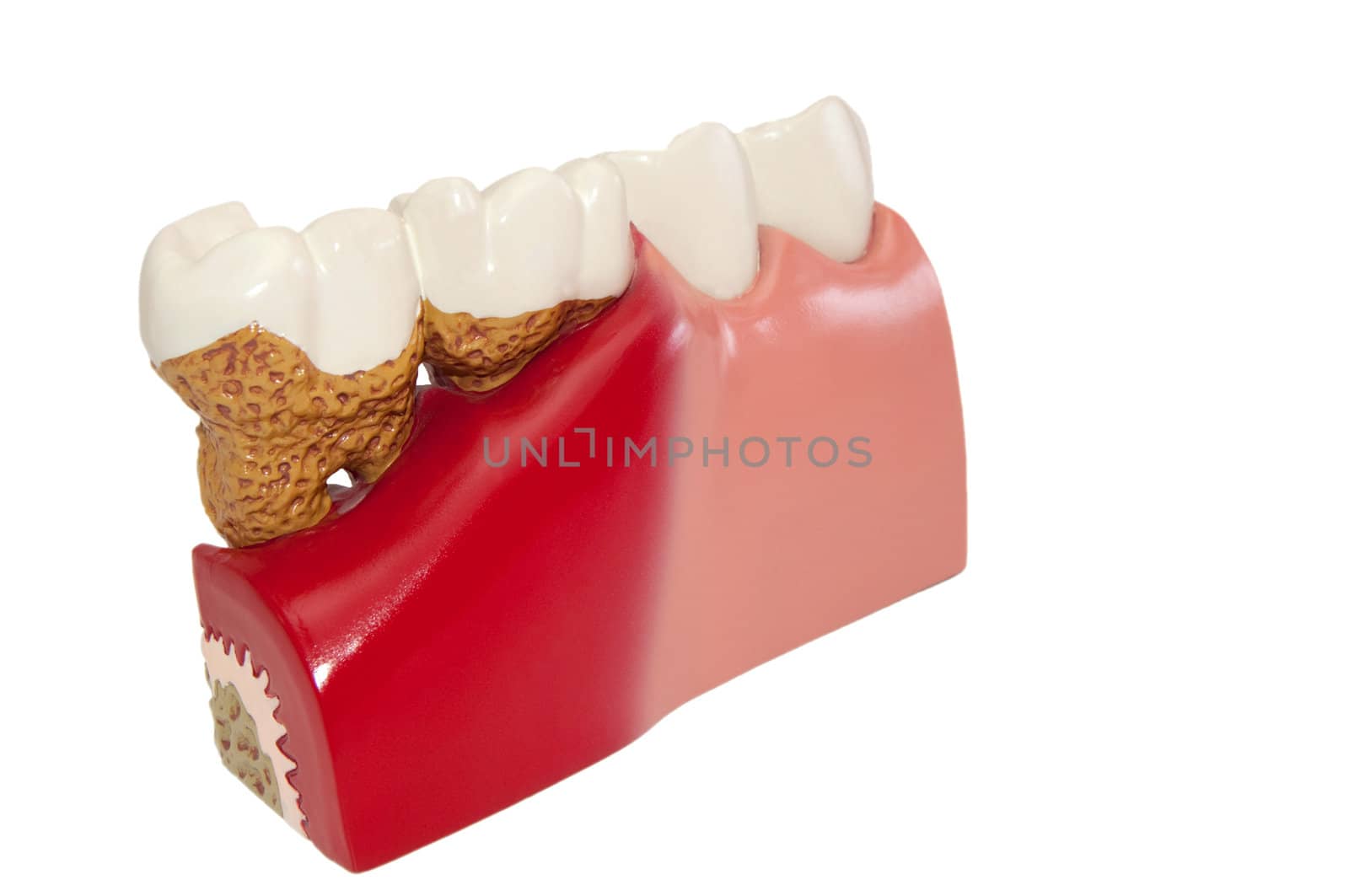 Dental Modell by franz_hein