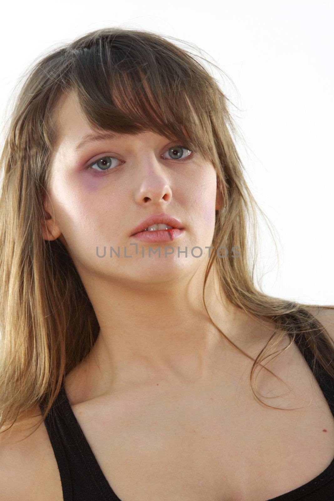 Abused girl over white background
