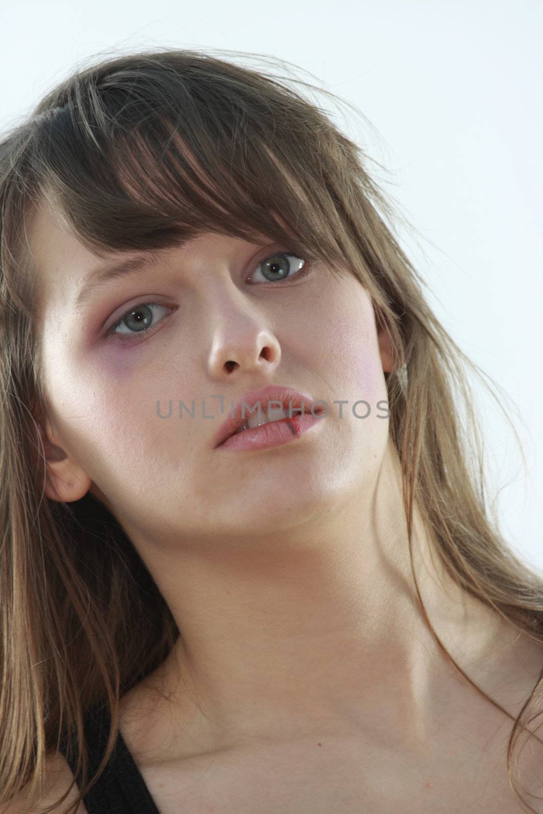 Abused girl over white background