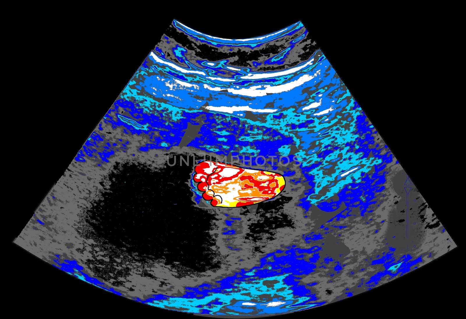 Painted ultrasound with a baby's foot - a raster illustration.