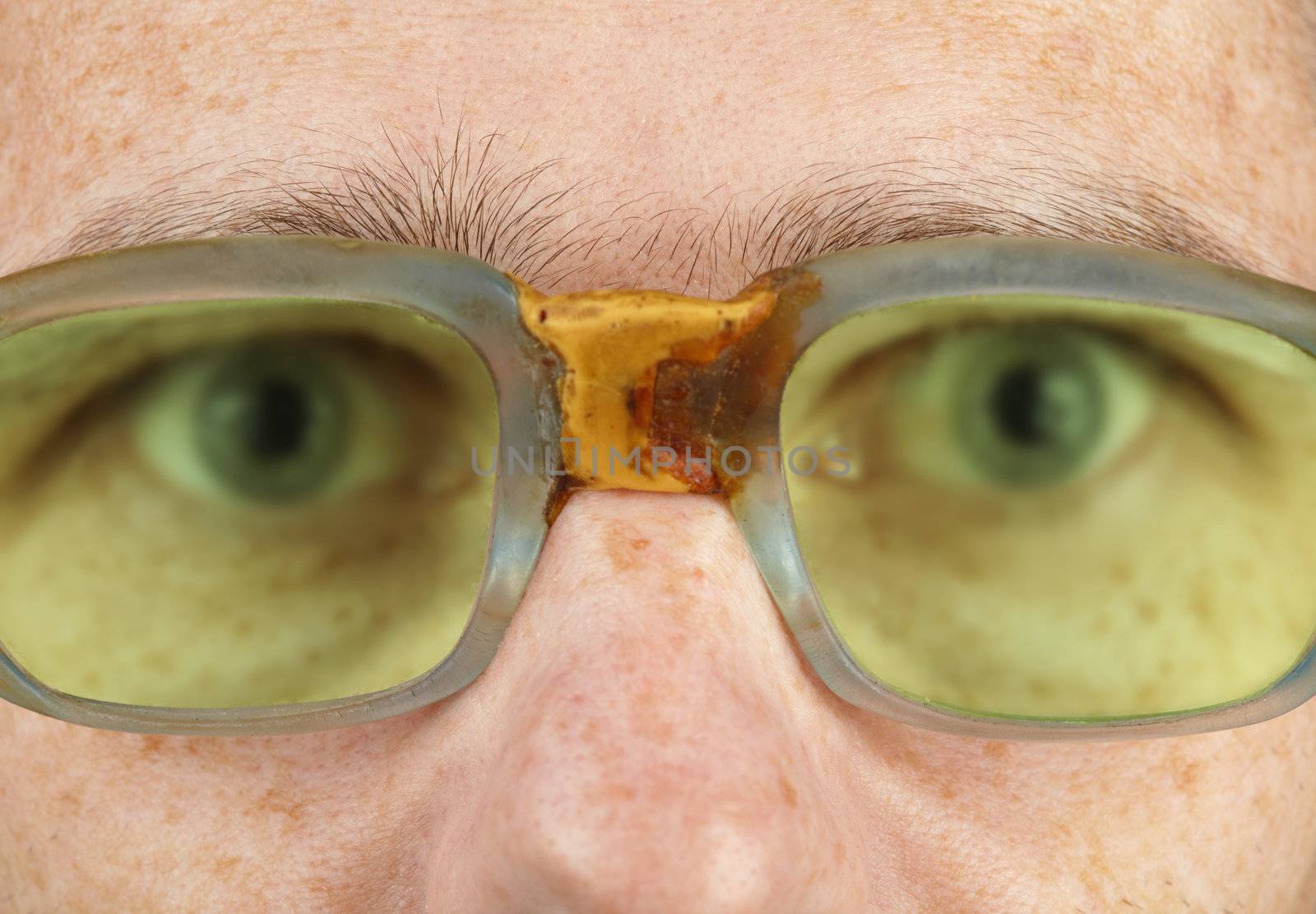 Person in old bad spectacles with poor eyesight by pzaxe