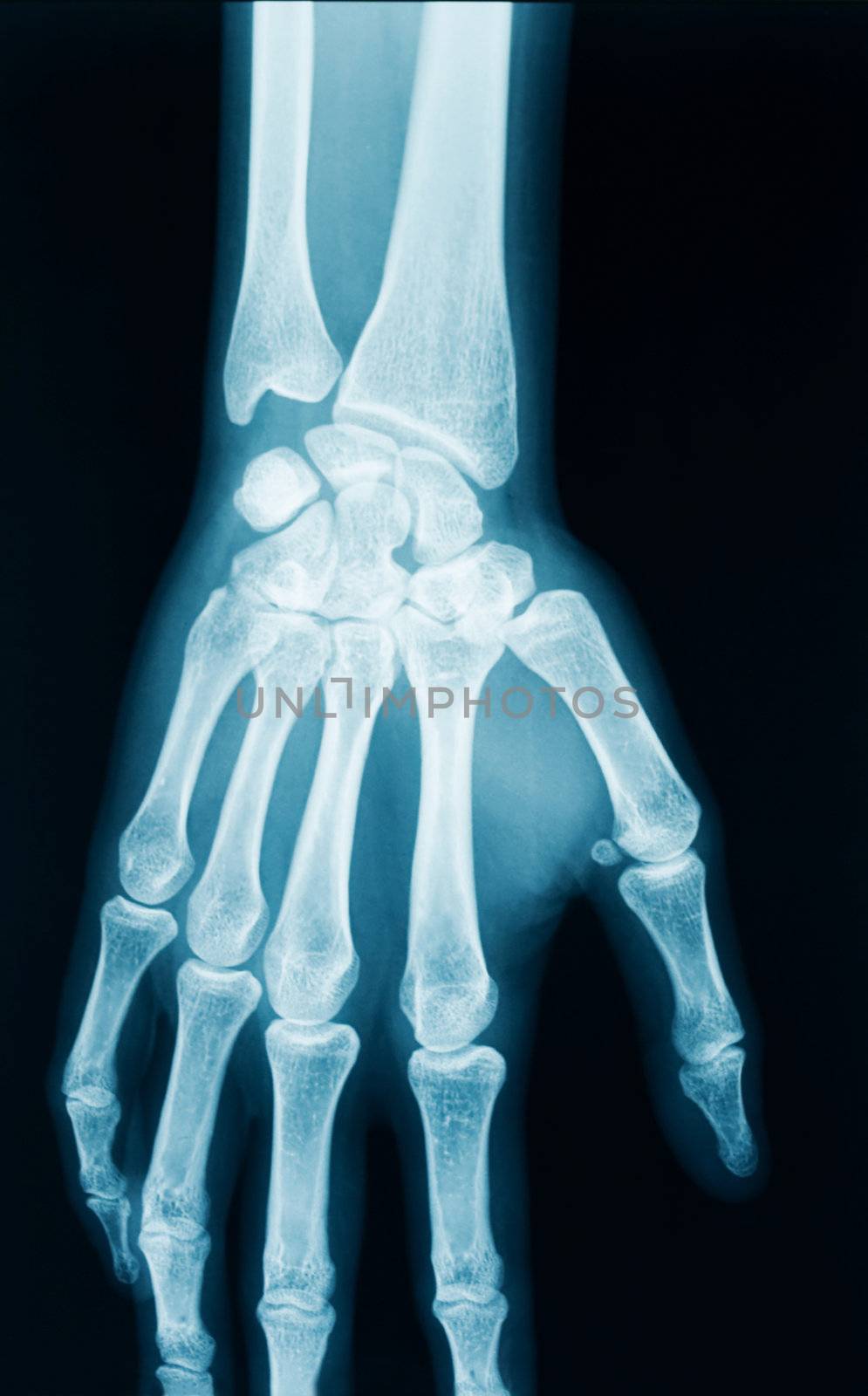 radiography of a middle aged woman