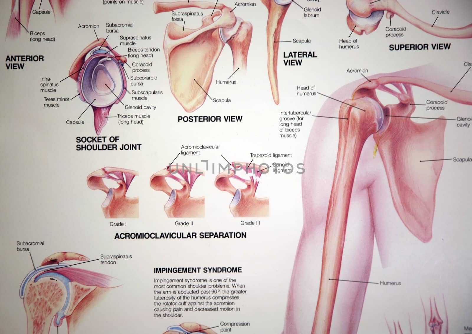 Medical chart showing a shoulder